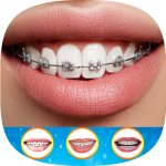 Download Braces Photo Editor 2019 1.1 Free Download APK,APP2019 Apk