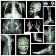 musculoskeletal x-ray interpretation GUIDE 1.0 Apk