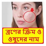 Download ব্রণের ক্রিম ও ওষুদের নাম~ Acne cream and medicine 1.0 APK For Android Apk