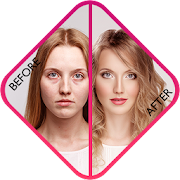 Download Before and After Collage 2.1 Apk for android Apk