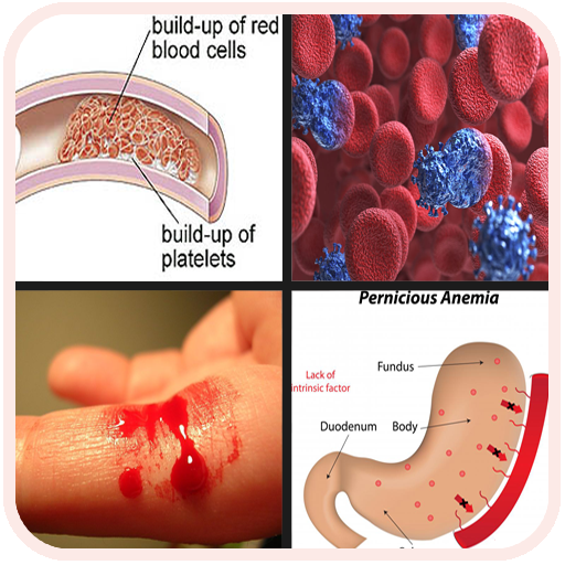 Download All Blood Disease & Treatment 12.9.32p Apk for android